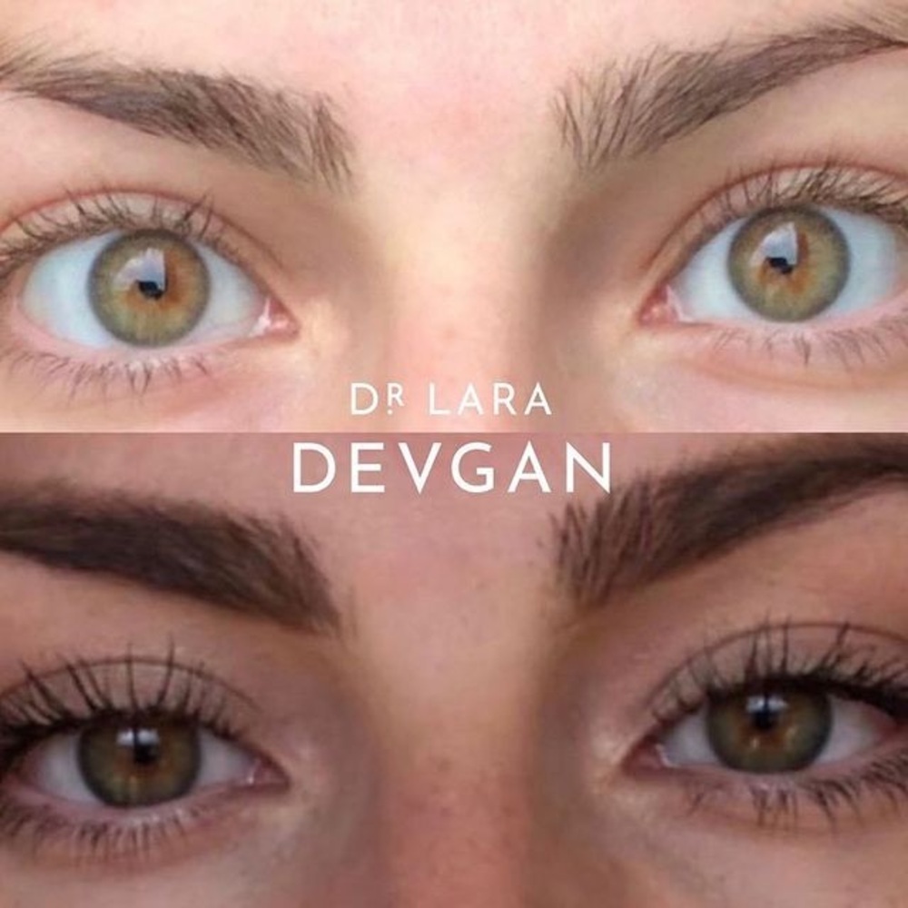 DR DEVGAN PLATINUM LONG LASH SERUM SCIENTIFIC BEAUTY VEGAN BEST MOST RESULTS NWT - Picture 8 of 14